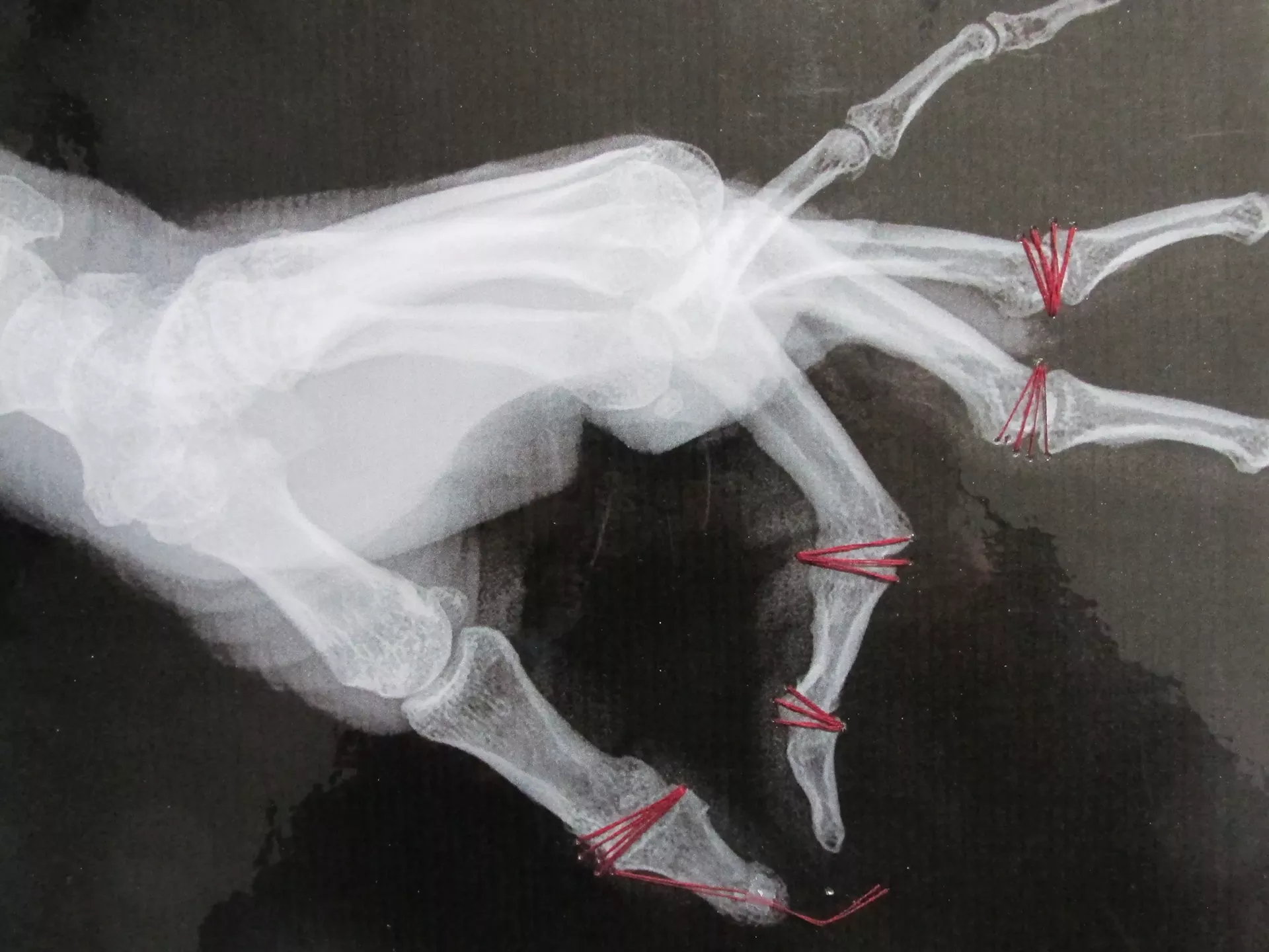 "Stitched Left Hand" by Sharon Webster