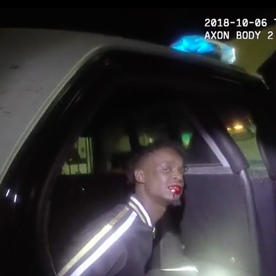 Image: Man Hurt During Arrest Sues Burlington Police for Excessive Force