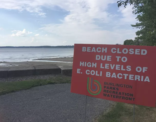 High E. Coli Levels Force Closures at Two Burlington Beaches