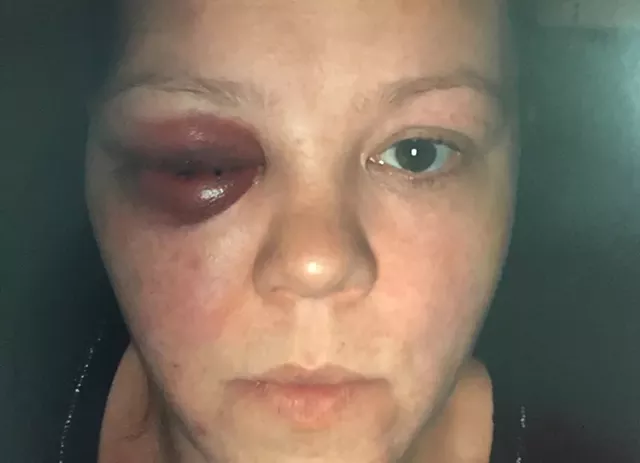 Beating of Handcuffed Woman Leads to More Fallout for St. Albans Cops