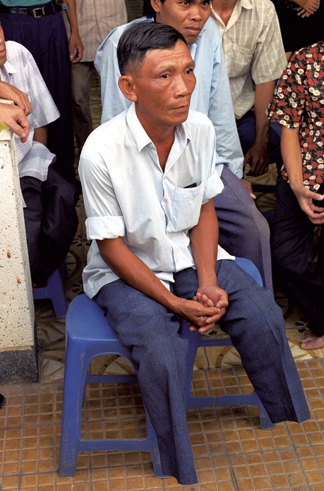 A Vietnamese land mine victim - COURTESY