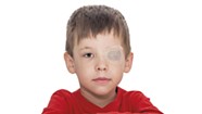 What Should Parents Know About Eye Exams, Bilateral Vision and the Proverbial 'Lazy Eye'?